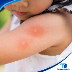 vợt muỗi - công dụng của vợt muỗi